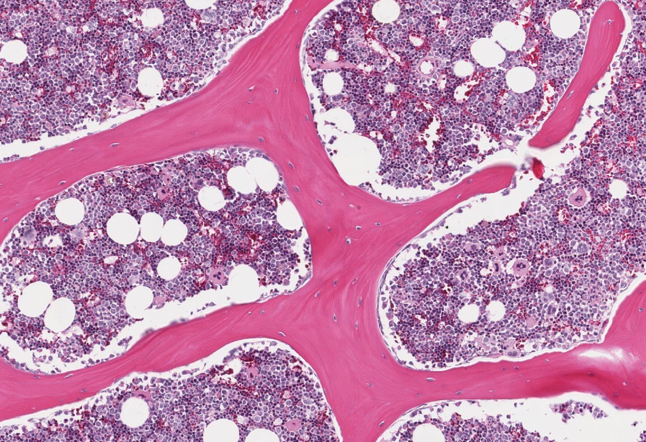 Circulating senescent myeloid cells drive blood brain barrier breakdown and neurodegeneration